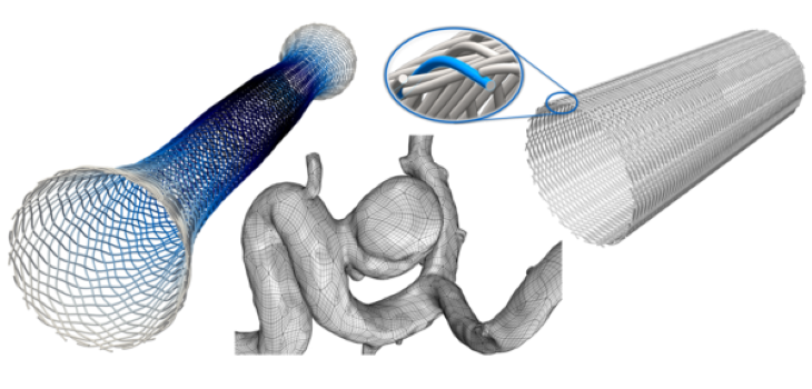 Enwicklung eines Design Tools für Flow Diverter Devices